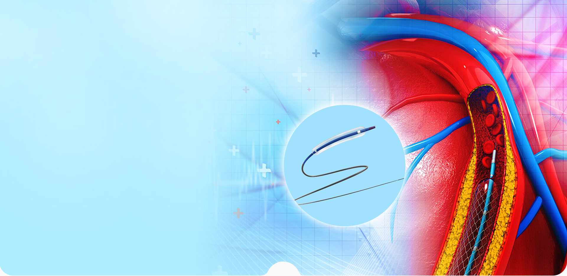 Ningbo Linstant Polymer Materials Co,. LTD.